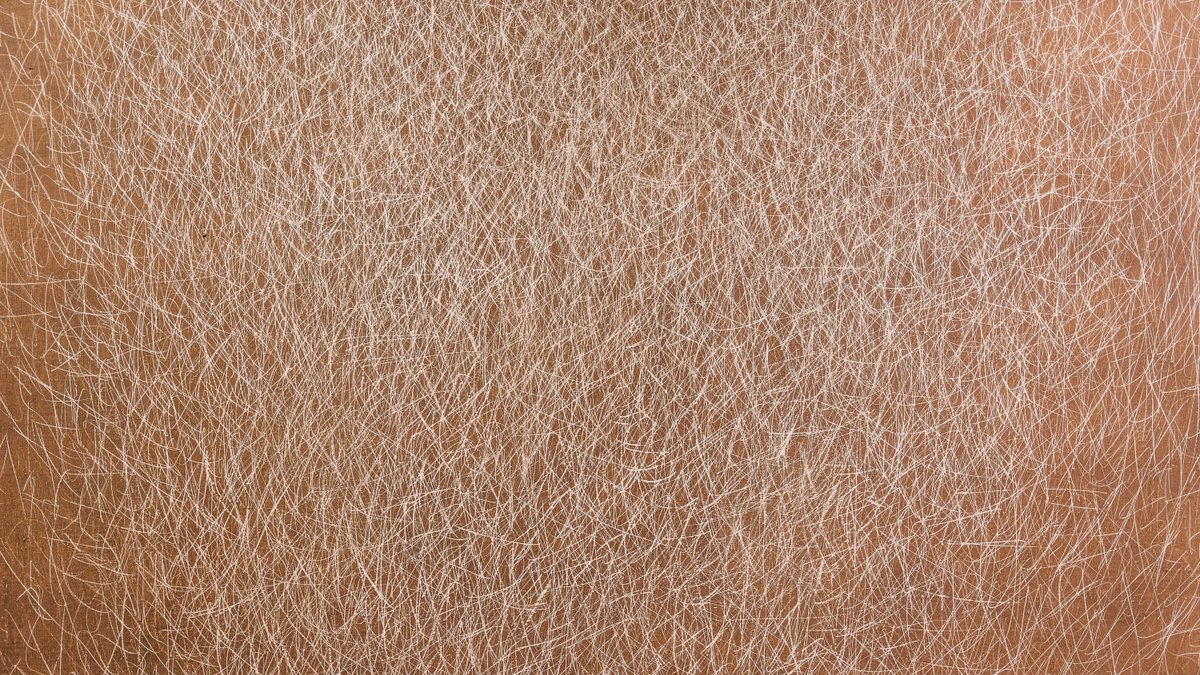 A close-up of skin texture in warm natural light.