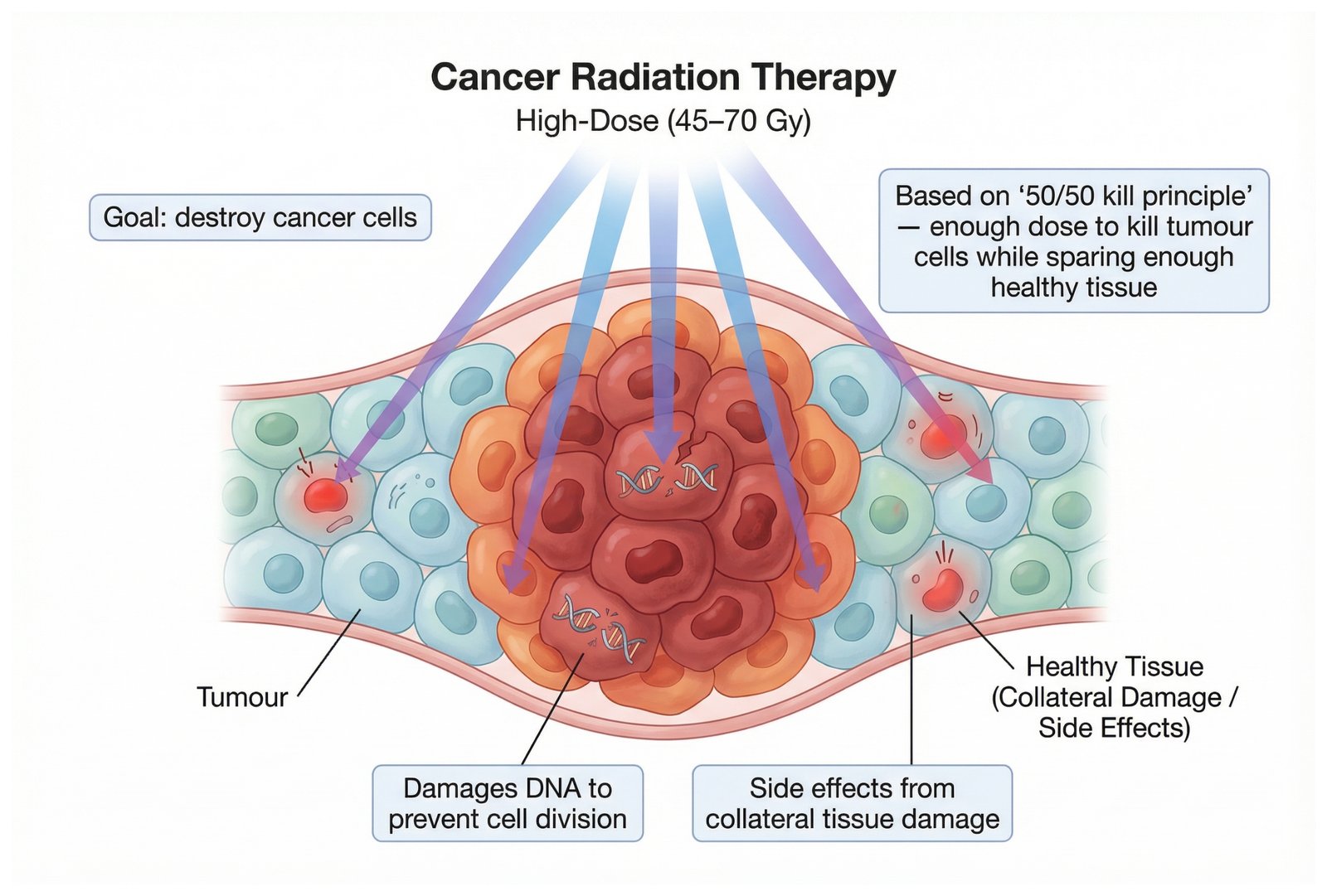 High-dose cancer radiation therapy at 45–70 Gy: damages cancer cell DNA to prevent cell division, with some collateral effect on healthy tissue.